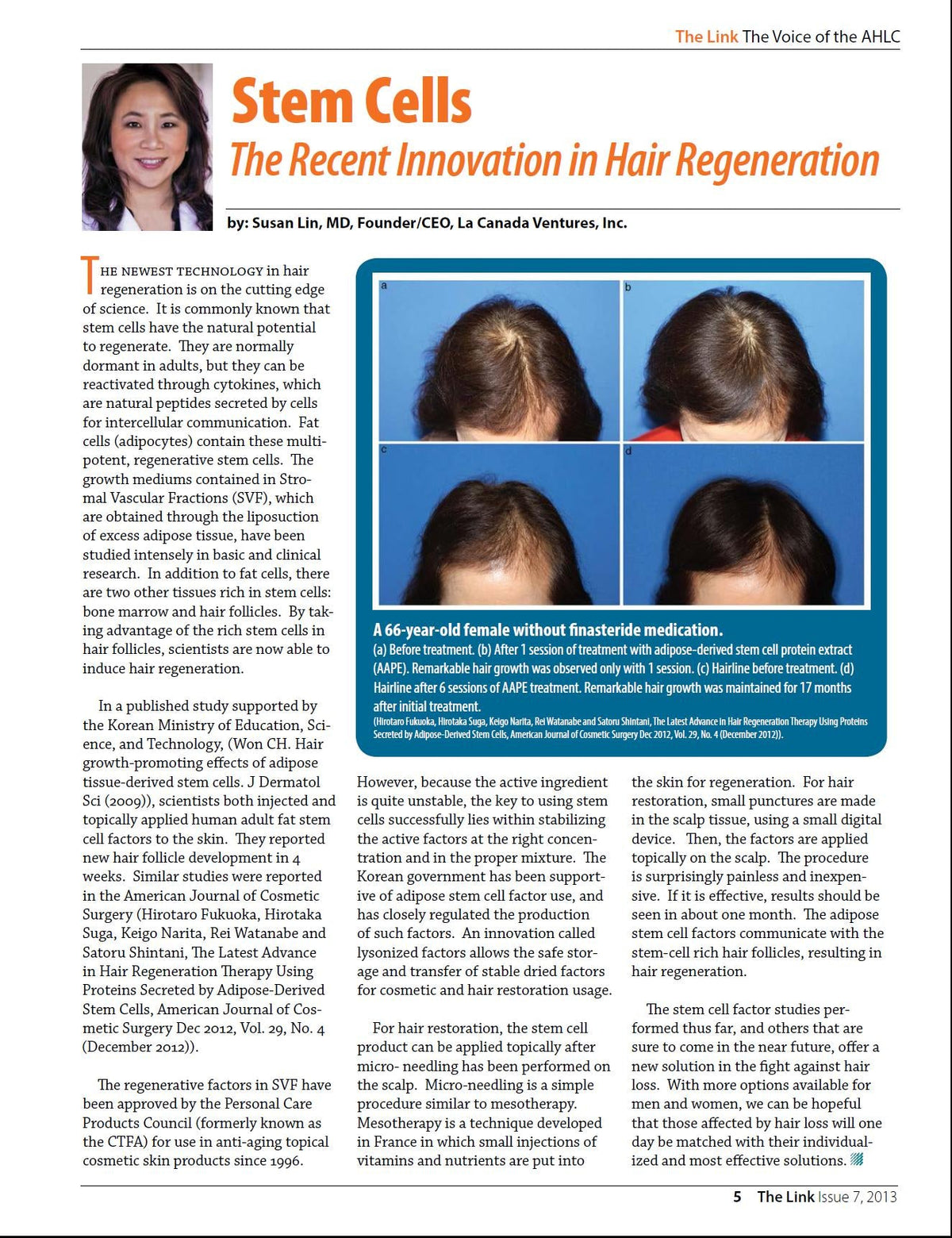 Scalp aging and hair density — MD Hair™ physician guide