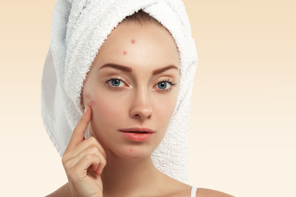 MD: An Effective, Scientific Approach to Acne Treatment