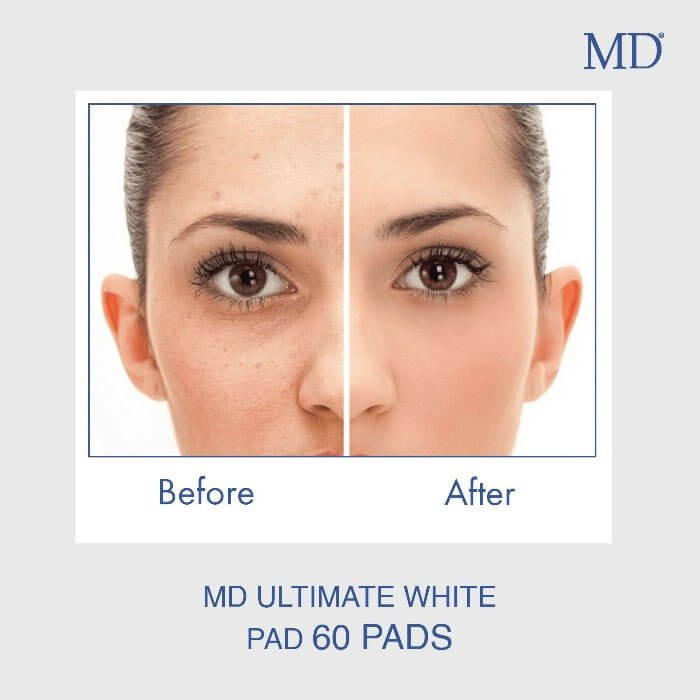 MD® Ultimate White Pad — before-and-after customer photos showing the look of more even skin tone. Individual results vary.