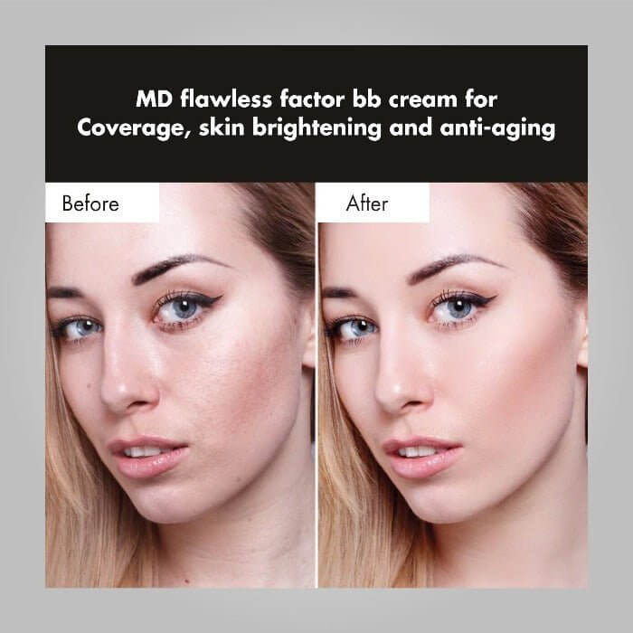 MD Flawless Factor BB Cream for Coverage, Skin Brightening & Anti-aging - 1.76 Fl Oz - MD