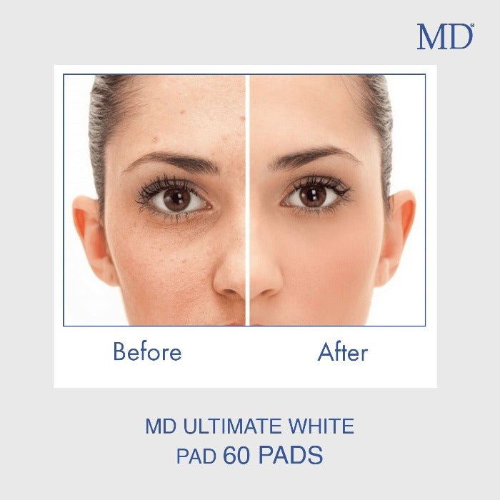 MD Ultimate white Pad - Face and Body Skin Whitening Pads Reduce Melasma - 60 pads - MD