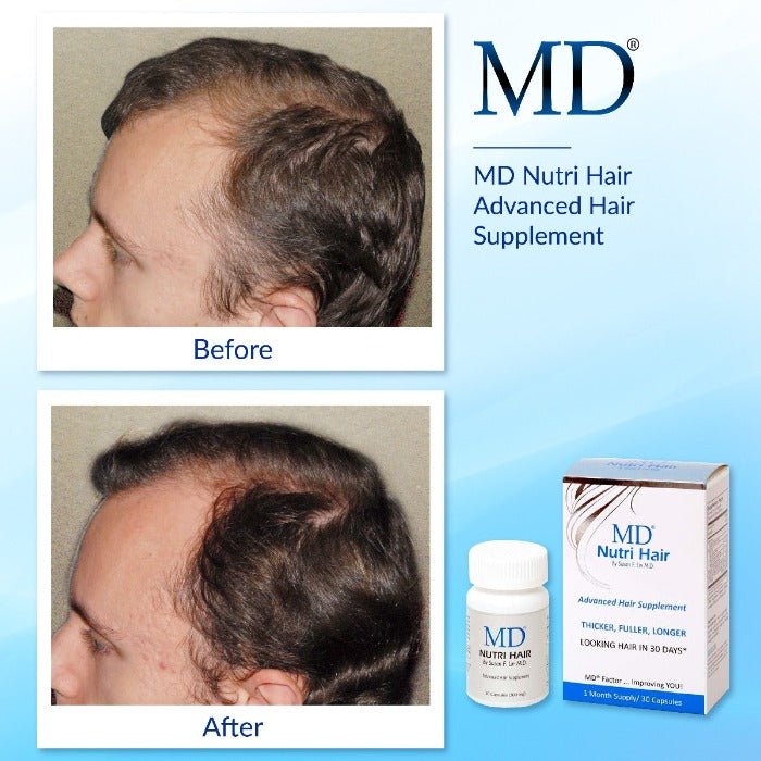 md nutri hair ultimate program before after