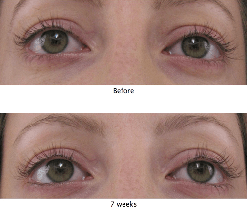 Real Lash Growth With Best Eyelash Conditioner MD Lash Factor