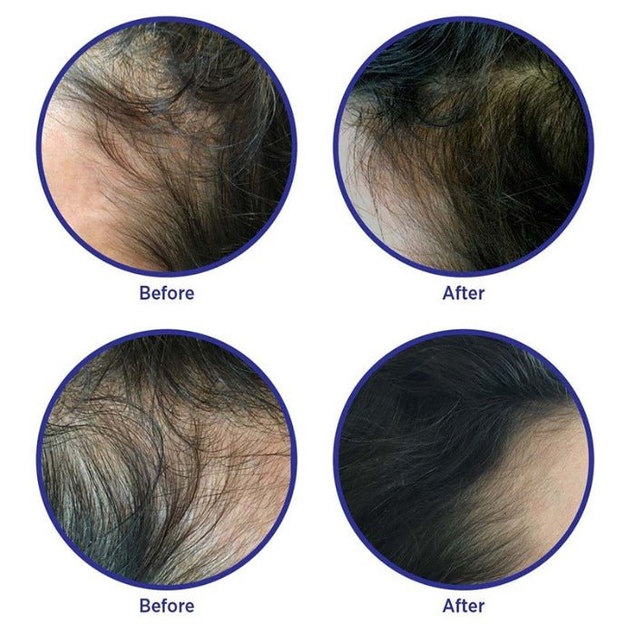 Before and After Photos MD Nutri Hair