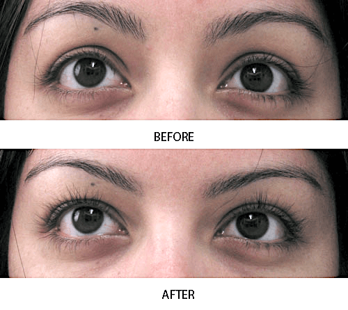 এমডি ল্যাশ ফ্যাক্টর ব্যবহারের ৪ সপ্তাহ পর আরব মহিলার চোখের দোররা লম্বা ও ঘন হয়ে ওঠার আগে এবং পরে নাটকীয়ভাবে বৃদ্ধি পেয়েছে।