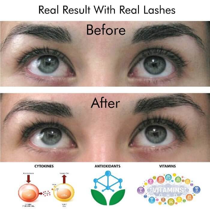 MD Lash Factor ব্যবহারের আগে এবং পরে ৬ মাসের সিরাম, যা মূল বৃদ্ধির উপাদান সহ আসল, লম্বা, ঘন পাপড়ি দেখায়