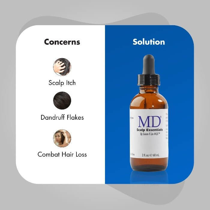 MD Scalp Essential bottle as solution for itchy scalp, dandruff flakes, and early hair loss support from the MD Hair collection

