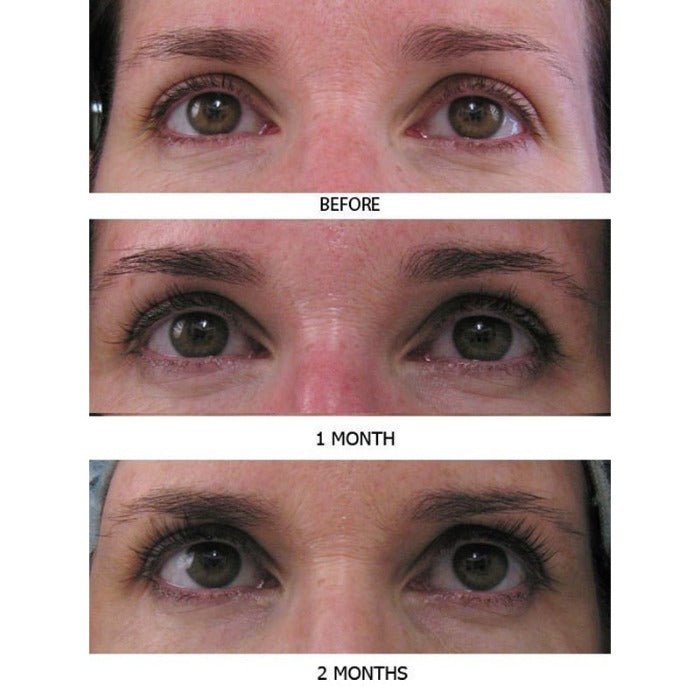 Eyelash Conditioner Before and After See Lashes Grow Longer with MD Lash Factor Grande Lash Revitalash