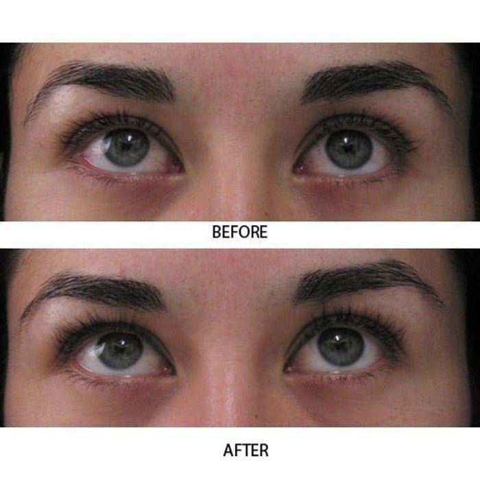 MD Lash Factor best eyelash conditioner to grow real lashes
