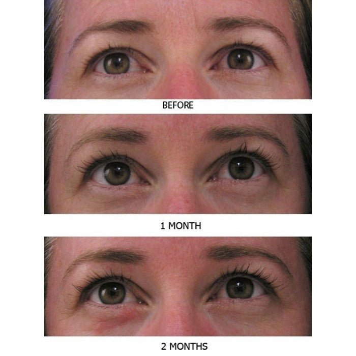 Real results after using MD Lash Factor eyelash serum at 4 and 8 weeks